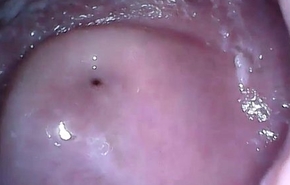 cam in frowardness vagina added to bore